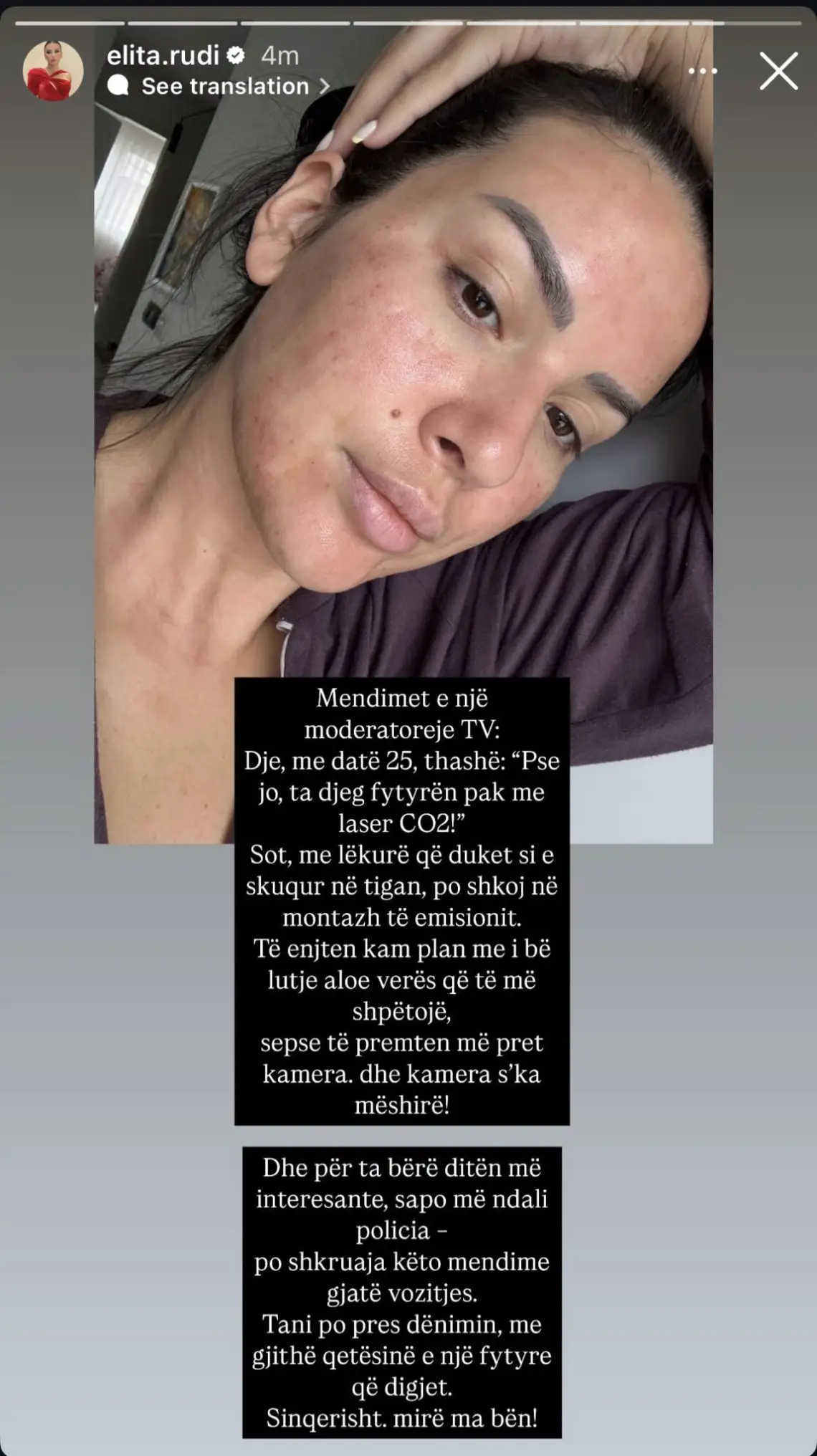 Elita Rudi zbulon problemet me Policinë 1 IMG 3761